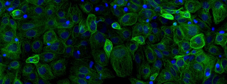 fittosize_950_352_b77394918bc0a304eb0b3daa4c17a3e4_tubulin_stain