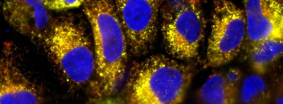 fittosize_950_352_f52d1414134d29040d17018fb0cb3b14_co-infected_cells